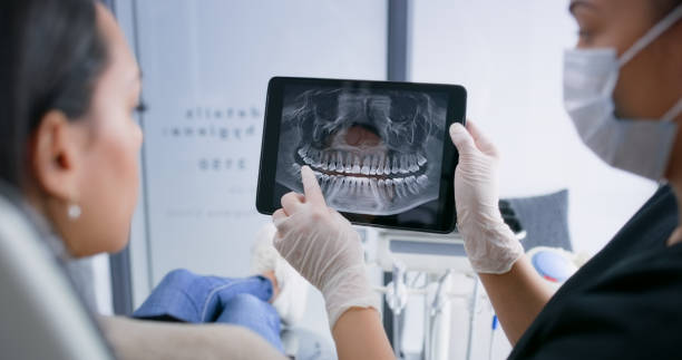 Licensed Tooth Extraction service in Galveston, IN - Smile Center Dentistry